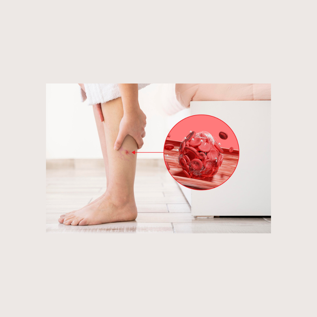 peripheral artery disease affecting blood circulation in legs