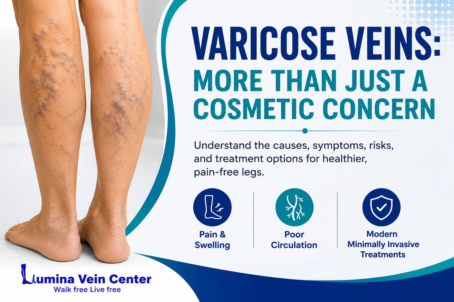 varicose veins
